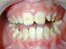 genetique dentaire 4