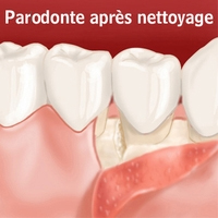 parodonte