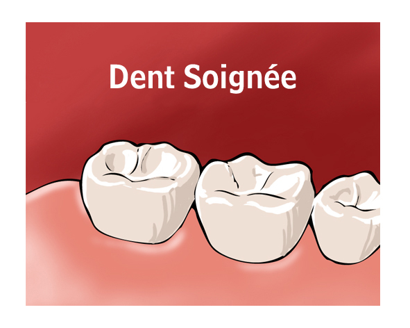 dent soignee