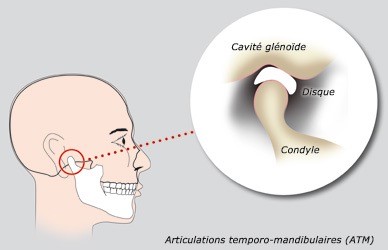 articulations temporo mandibulaires