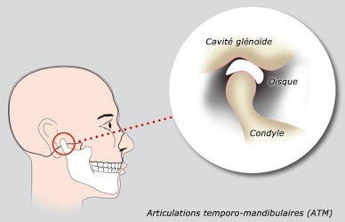 DAM et articulations temporo-mandibulaires (ATM)