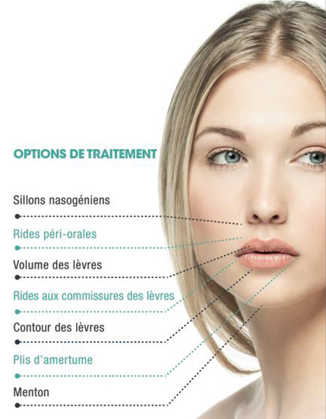 injections acide hyaluronique 2